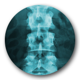 Spinal Decompression Patient